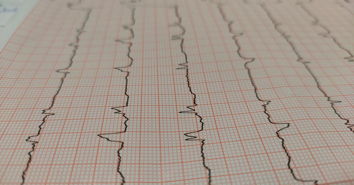 Profilaktyka chorób serca po 50 roku życia